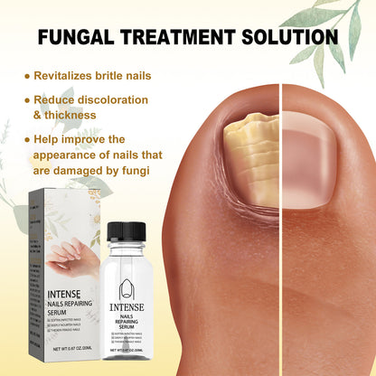 Hand And Foot Gray Nail Soft Yellow Thickening Bright Cleaning Repair