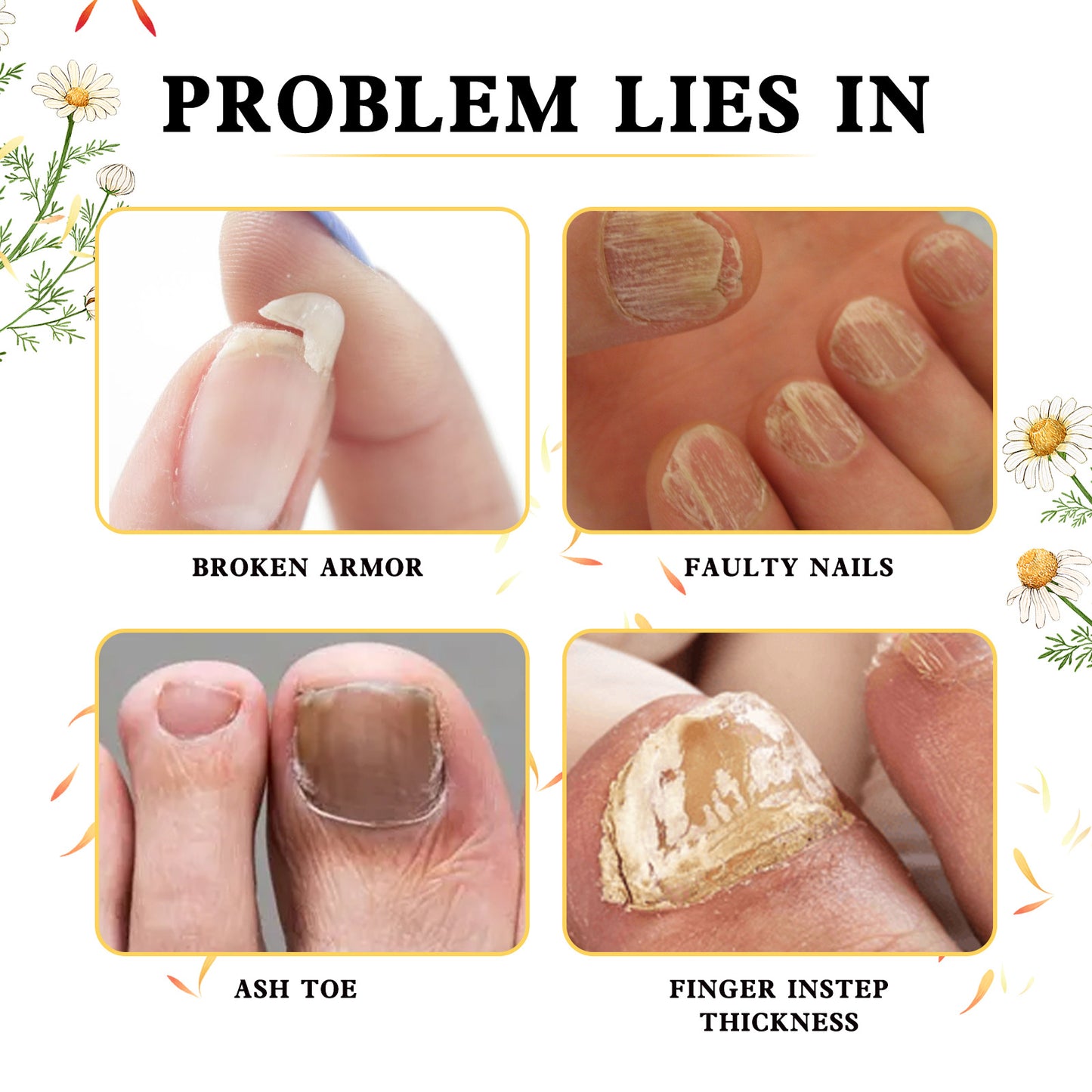 Hand And Foot Gray Nail Soft Yellow Thickening Bright Cleaning Repair