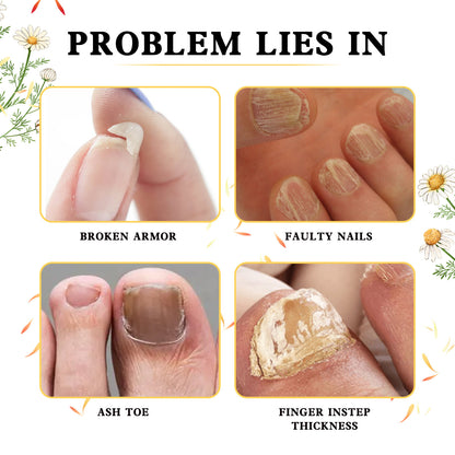 Hand And Foot Gray Nail Soft Yellow Thickening Bright Cleaning Repair